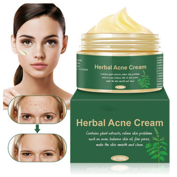 OEM Custom Herbal Acne Scar Removal Brightening Cream